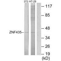 Western blot analysis of extracts from NIH-3T3 cells and HT-29 cells, using ZNF435 antibody. Western blot analysis of extracts from NIH-3T3 cells and HT-29 cells, using ZNF435 antibody.