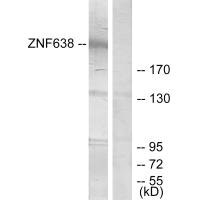 Western blot analysis of extracts from HepG2 cells, treated with serum (20%, 15mins), using ZNF638 antibody. Western blot analysis of extracts from HepG2 cells, treated with serum (20%, 15mins), using ZNF638 antibody.