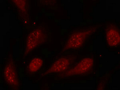 Immunofluorescence staining of methanol-fixed Hela cells using p53(Phospho-Ser315) Antibody.