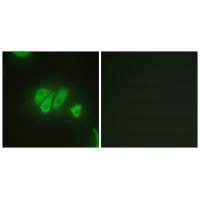 Immunofluorescence analysis of HepG2 cells, using PDZD2 antibody.