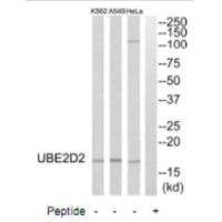 Western blot analysis of extracts from HeLa cells, A549 cells and K562 cells, using UBE2D2 antibody. Western blot analysis of extracts from HeLa cells, A549 cells and K562 cells, using UBE2D2 antibody.