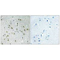 Immunohistochemistry analysis of paraffin-embedded human brain tissue using TFE3 antibody.