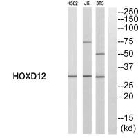 Western blot analysis of extracts from K562, JK and 3T3 cells using HOXD12 antibody. Western blot analysis of extracts from K562, JK and 3T3 cells using HOXD12 antibody.