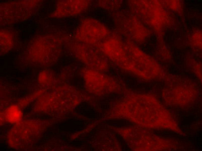 Immunofluorescence staining of methanol-fixed Hela cells using Stathmin 1(Ab-38) Antibody.