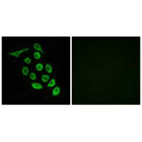 Immunofluorescence analysis of A549 cells, using RPS12 antibody.