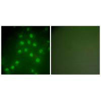 Immunofluorescence analysis of HepG2 cells, using HDAC9 antibody.