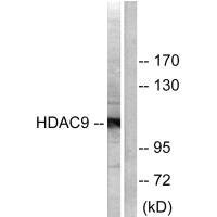 Western blot analysis of extracts from HepG2 cells, using HDAC9 antibody. Western blot analysis of extracts from HepG2 cells, using HDAC9 antibody.