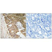 Immunohistochemistry analysis of paraffin-embedded human colon carcinoma tissue, using ZC3H8 antibody.