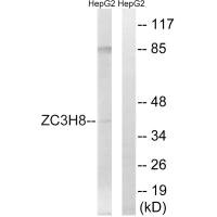 Western blot analysis of extracts from HepG2 cells, using ZC3H8 antibody. Western blot analysis of extracts from HepG2 cells, using ZC3H8 antibody.