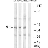 Western blot analysis of extracts from Jurkat cells, HUVEC cells and HepG2 cells, using NT antibody. Western blot analysis of extracts from Jurkat cells, HUVEC cells and HepG2 cells, using NT antibody.