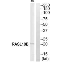 Western blot analysis of extracts from 3T3 cells, using RASL10B antibody. Western blot analysis of extracts from 3T3 cells, using RASL10B antibody.