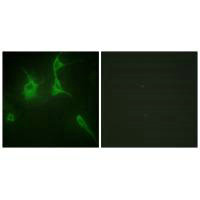Immunofluorescence analysis of NIH/3T3 cells, using Collagen IX alpha3 antibody.