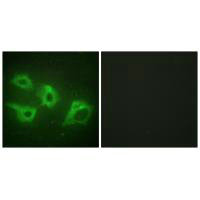 Immunofluorescence analysis of HeLa cells, using CKI-alpha antibody.