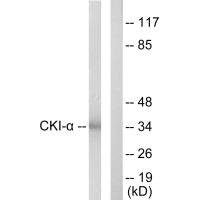 Western blot analysis of extracts from HeLa cells, using CKI-alpha antibody. Western blot analysis of extracts from HeLa cells, using CKI-alpha antibody.