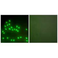 Immunofluorescence analysis of A549 cells, using Ku70/80 antibody.