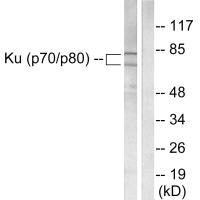 Western blot analysis of extracts from LOVO cells, using Ku70/80 antibody.