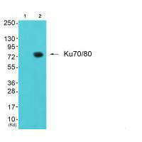 Western blot analysis of extracts from JK cells (Lane 2), using Ku80 antiobdy. The lane on the left is treated with synthesized peptide.