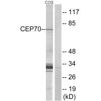 Western blot analysis of extracts from COS cells, using CEP70 antibody. Western blot analysis of extracts from COS cells, using CEP70 antibody.