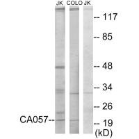 Western blot analysis of extracts from Jurkat cells and COLO205 cells, using CA057 antibody. Western blot analysis of extracts from Jurkat cells and COLO205 cells, using CA057 antibody.