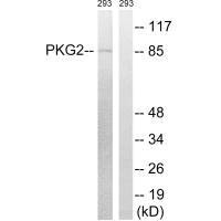 Western blot analysis of extracts from 293 cells, treated with anisomycin (25ug/ml, 30mins), using PKG2 (Ab-126) antibody. Western blot analysis of extracts from 293 cells, treated with anisomycin (25ug/ml, 30mins), using PKG2 (Ab-126) antibody.