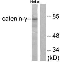 Western blot analysis of extracts from HeLa cells, using Catenin-gamma antibody.