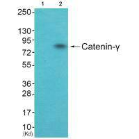 Western blot analysis of extracts from HuvEc cells (Lane 2), using Catenin-gamma antiobdy. The lane on the left is treated with systhesized peptide.
