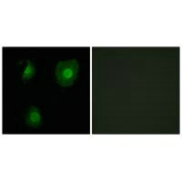 Immunofluorescence analysis of A549 cells, using EID1 antibody.