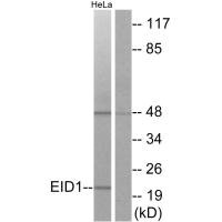 Western blot analysis of extracts from HeLa cells, using EID1 antibody. Western blot analysis of extracts from HeLa cells, using EID1 antibody.