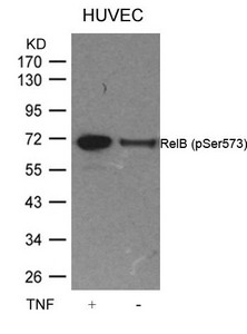 Western blot analysis of extracts from HUVEC cells untreated or treated with TNF using RelB(Phospho-Ser573) Antibody. Western blot analysis of extracts from HUVEC cells untreated or treated with TNF using RelB(Phospho-Ser573) Antibody.