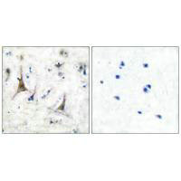 Immunohistochemical analysis of paraffin-embedded human brain tissue using PGP9.5 antibody. Immunohistochemical analysis of paraffin-embedded human brain tissue using PGP9.5 antibody.