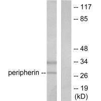 Western blot analysis of extracts from 293 cells, using PGP9.5 antibody.