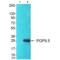 Western blot analysis of extracts from 293 cells (Lane 2), using PGP9.5 antiobdy. The lane on the left is treated with systhesized peptide.