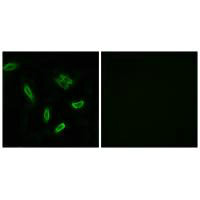 Immunofluorescence analysis of A549 cells, using SLC27A5 antibody.