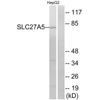 Western blot analysis of extracts from HepG2 cells, using SLC27A5 antibody. Western blot analysis of extracts from HepG2 cells, using SLC27A5 antibody.