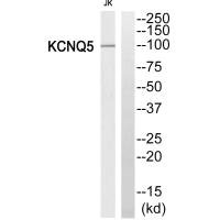Western blot analysis of extracts from Jurkat cells, using KCNQ5 antibody. Western blot analysis of extracts from Jurkat cells, using KCNQ5 antibody.