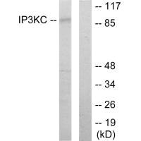 Western blot analysis of extracts from HT-29 cells, using IP3KC antibody. Western blot analysis of extracts from HT-29 cells, using IP3KC antibody.
