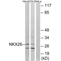 Western blot analysis of extracts from HeLa cells and COLO cells, using NKX26 antibody. Western blot analysis of extracts from HeLa cells and COLO cells, using NKX26 antibody.