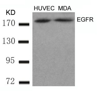 Western blot analysis of extracts from HUVEC and MDA cells using EGFR(Ab-869) Antibody. Western blot analysis of extracts from HUVEC and MDA cells using EGFR(Ab-869) Antibody.