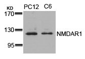 Western blot analysis of extracts from PC12 and C6 cells using NMDAR1(Ab-896) Antibody. Western blot analysis of extracts from PC12 and C6 cells using NMDAR1(Ab-896) Antibody.