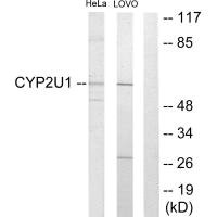 Western blot analysis of extracts from HeLa cells and Lovo cells, using Cytochrome P450 2U1 antibody. Western blot analysis of extracts from HeLa cells and Lovo cells, using Cytochrome P450 2U1 antibody.