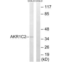 Western blot analysis of extracts from COLO cells, using AKR1C2 antibody. Western blot analysis of extracts from COLO cells, using AKR1C2 antibody.
