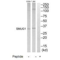 Western blot analysis of extracts from 293 and COS7 cells, using SMUG1 antibody. Western blot analysis of extracts from 293 and COS7 cells, using SMUG1 antibody.