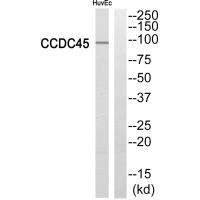 Western blot analysis of extracts from HuvEc cells, using CCDC45 antibody. Western blot analysis of extracts from HuvEc cells, using CCDC45 antibody.