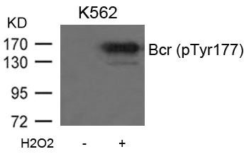 Western blot analysis of extracts from K562 cells untreated or treated with H2O2 using Bcr(Phospho-Tyr177) Antibody. Western blot analysis of extracts from K562 cells untreated or treated with H2O2 using Bcr(Phospho-Tyr177) Antibody.