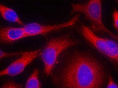 Immunofluorescence staining of methanol-fixed Hela cells using PKD/PKCm(Phospho-Ser738) Antibody.