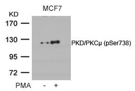 Western blot analysis of extracts from MCF cells untreated or treated with PMA using PKD/PKCm(Phospho-Ser738) Antibody. Western blot analysis of extracts from MCF cells untreated or treated with PMA using PKD/PKCm(Phospho-Ser738) Antibody.