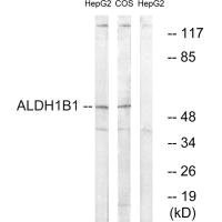 Western blot analysis of extracts from HepG2 cells and COS cells, using ALDH1B1 antibody. Western blot analysis of extracts from HepG2 cells and COS cells, using ALDH1B1 antibody.