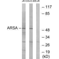 Western blot analysis of extracts from Jurkat cells and COLO cells, using ARSA antibody. Western blot analysis of extracts from Jurkat cells and COLO cells, using ARSA antibody.