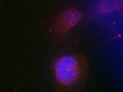 Immunofluorescence staining of methanol-fixed Hela cells using BRCA1(Phospho-Ser988) Antibody. Immunofluorescence staining of methanol-fixed Hela cells using BRCA1(Phospho-Ser988) Antibody.