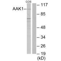 Western blot analysis of extracts from COS7 cells, using AAK1 antibody. Western blot analysis of extracts from COS7 cells, using AAK1 antibody.